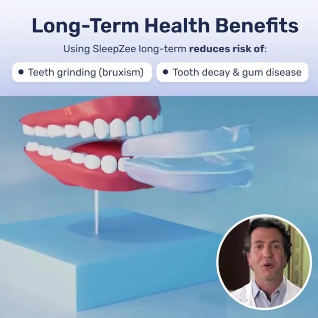 Mandibular Advancement Device image