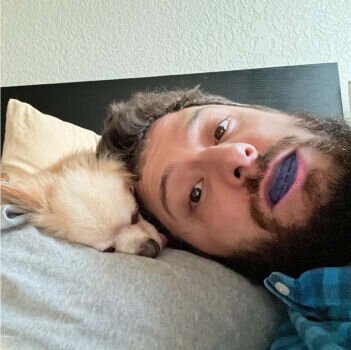 Mandibular Advancement Device image