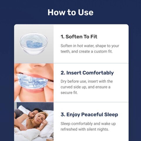 Mandibular Advancement Device image